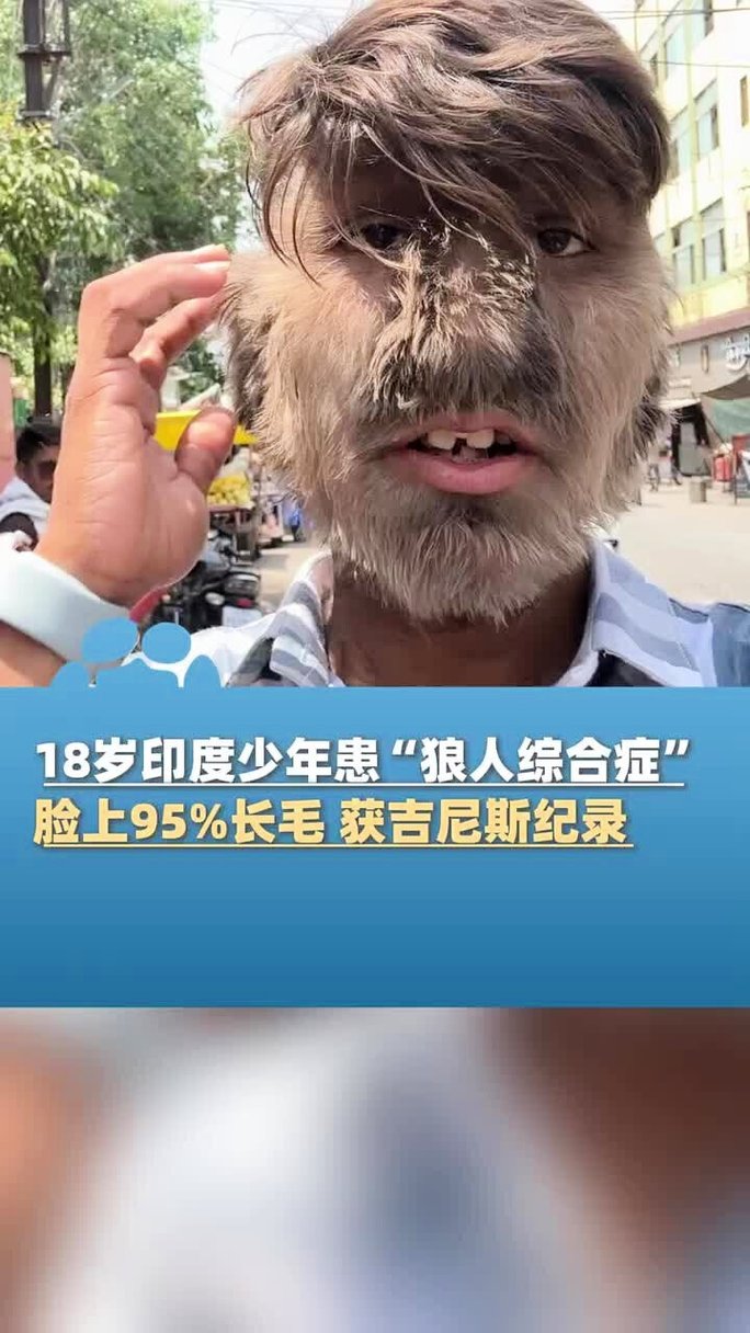 男女高潮又爽又黄又无遮挡的相关介绍